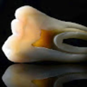 Meet your Posher, Oscar